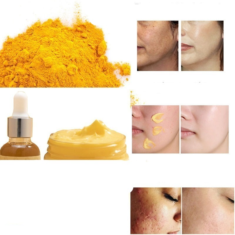 Collection Sofia / Ensemble de Curcuma et de Gingembre.
